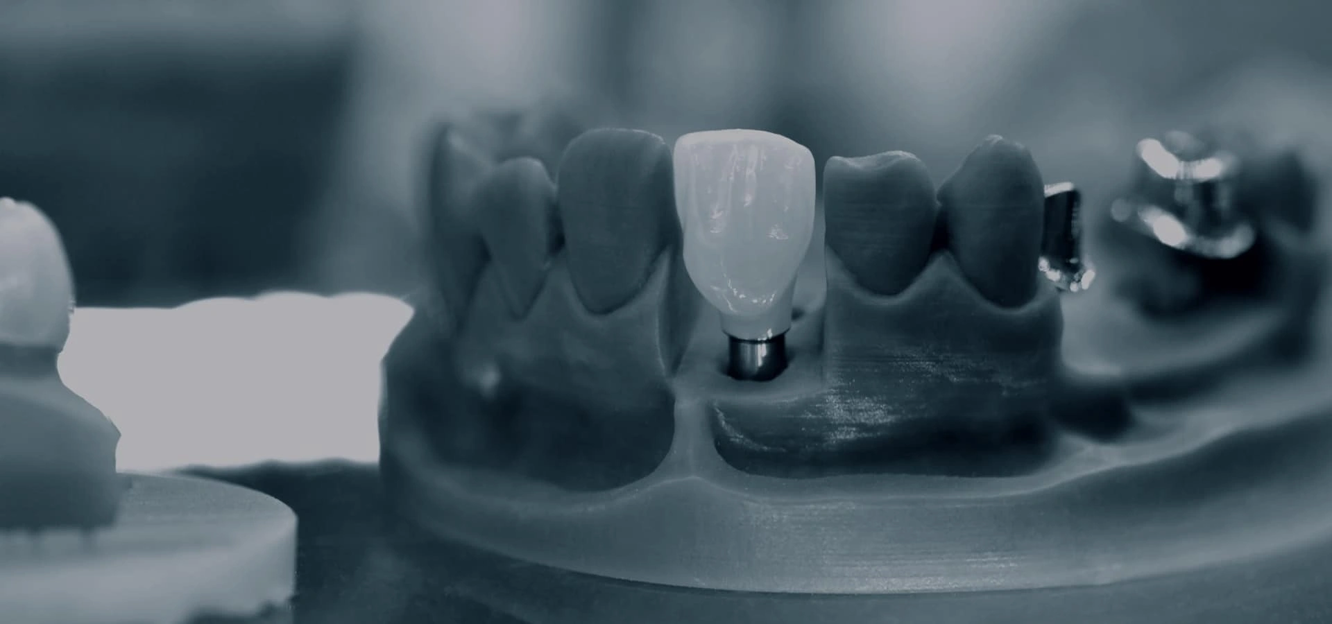 Dental implant models displayed on gray surface showing various tooth restoration options and designs.