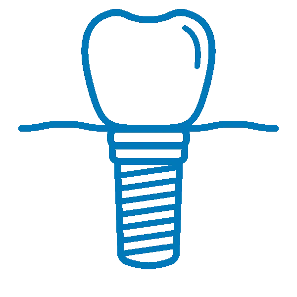 Blue line drawing of a dental implant showing crown, abutment, and threaded post.